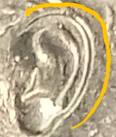 1985-D-Roosevelt-Dime-Ear-Error