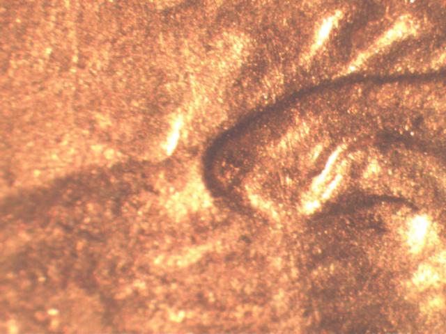 03-Under-Ear