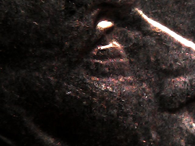 2000-D-LMC,-Thickness-Under-Eye