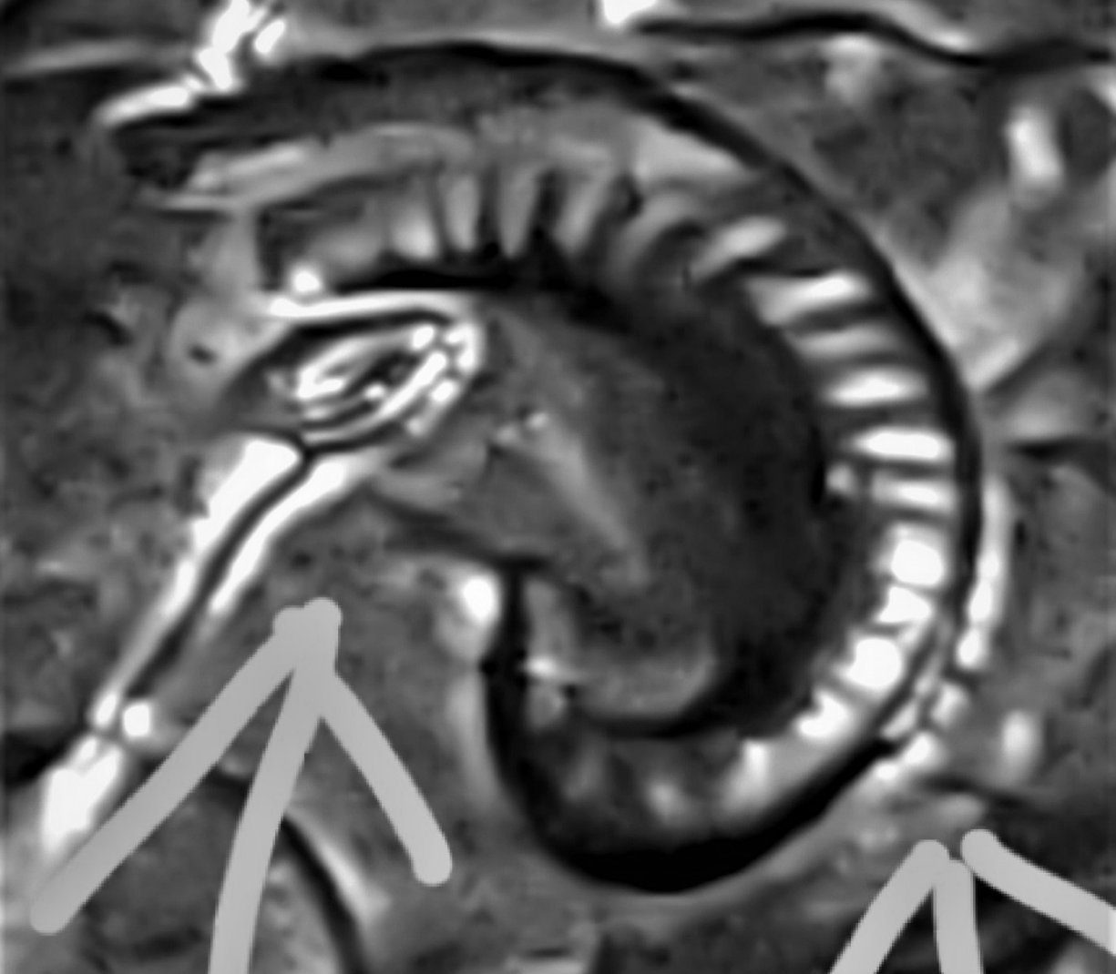 Denali-2012-D-Double-Die-Ear-And-Horn