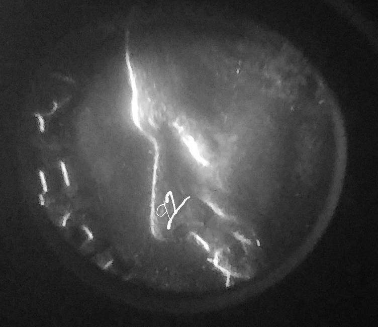 Is-It-Normal-Or-Unusual-For-This-To-Be-On-A-Roosevelt-Dime
