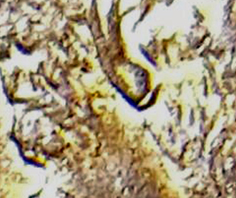 Is-This-A-1994-Lincoln-Cent-Doubled-Ear?