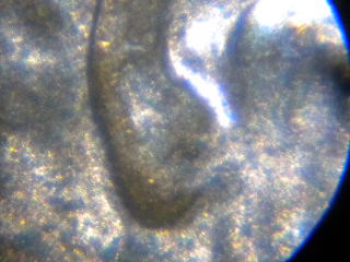 1997-P-LMC-Doubled-Ear-Lobe-Or-Not
