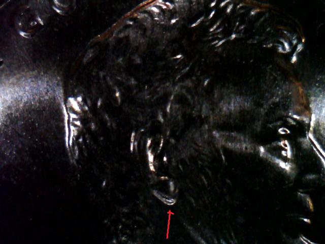 DDO-Doubled-Ear-Vs-A-Normal-Contact-Damaged-On-The-Earlobe.