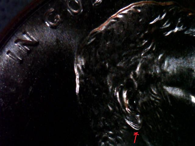 DDO-Doubled-Ear-Vs-A-Normal-Contact-Damaged-On-The-Earlobe.