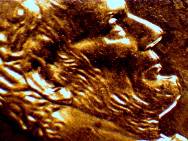 DDO-Doubled-Ear-Vs-A-Normal-Contact-Damaged-On-The-Earlobe.