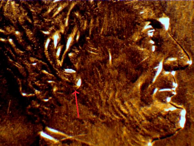 DDO-Doubled-Ear-Vs-A-Normal-Contact-Damaged-On-The-Earlobe.