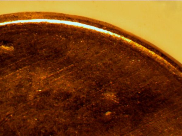 Penny-Almost-Clear,-Error-Or-MD?
