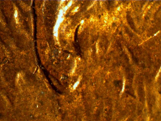 1997-Penny,-Ear-Lobe-Or-MD?