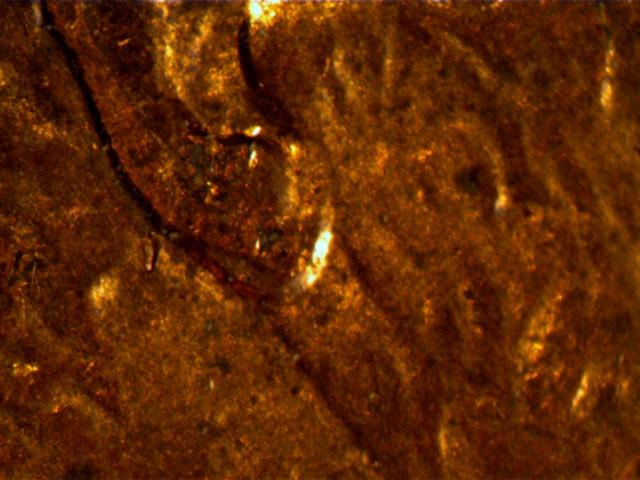 1997-Penny,-Ear-Lobe-Or-MD?