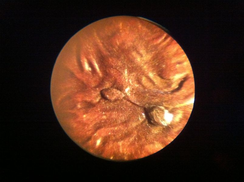 1998-LMC-Double-Tumor-Die-Crack?