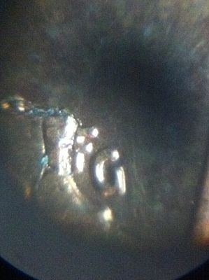 1989-LMC-Any-Idea-Whats-Going-On-With-This-Coin?