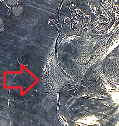 What-Causes-This?