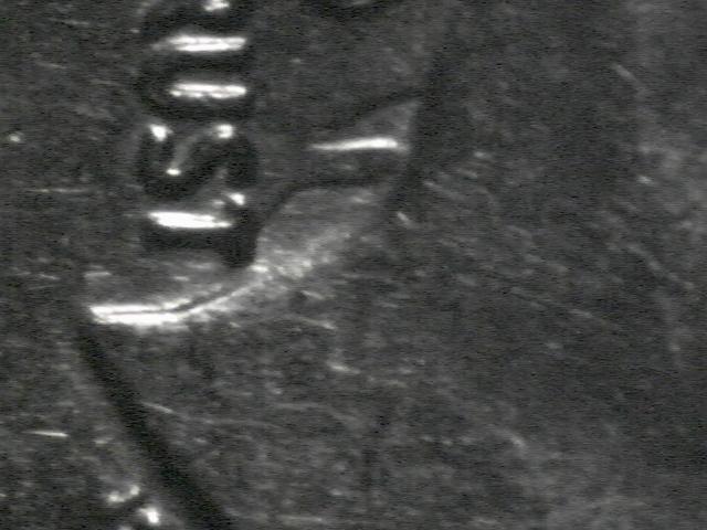 2000-D-Roosevelt-Dime-Error