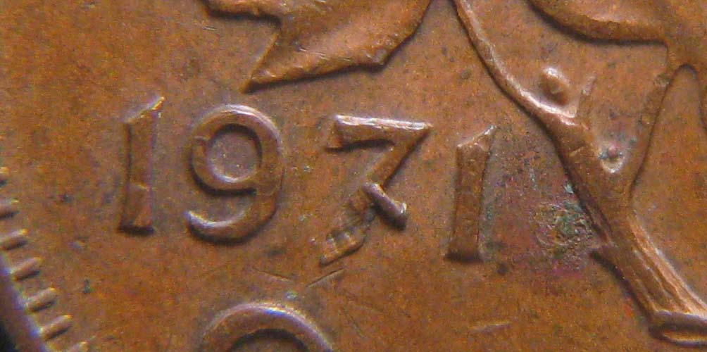 1971-Broken-Leg