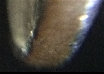 Are-KHDs-W/O-Reeded-Edges-Rare?