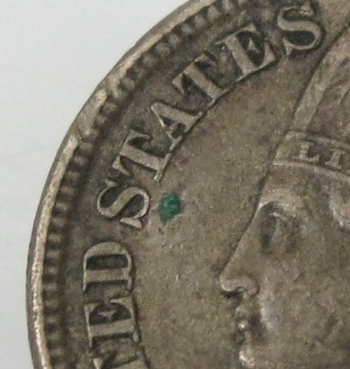 V-Nickel-+-IHC-Before-&-After-Verdi-Care-/-Acetone-Treatment