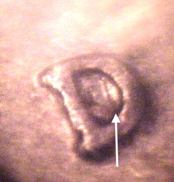 Double-Lip-Washington