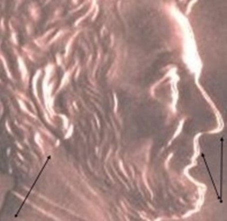 2006-DDO-Ear-Lobe/Beard-Stage-A