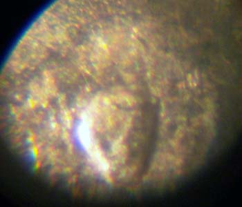 1964-D-Quarter-Nose-Wart!-8x-+-Macro
