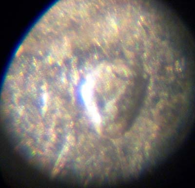 1964-D-Quarter-Nose-Wart!-8x-+-Macro