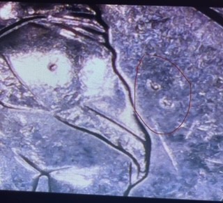 2016-D-Fort-Moultrie-Quarter--Die-Error?