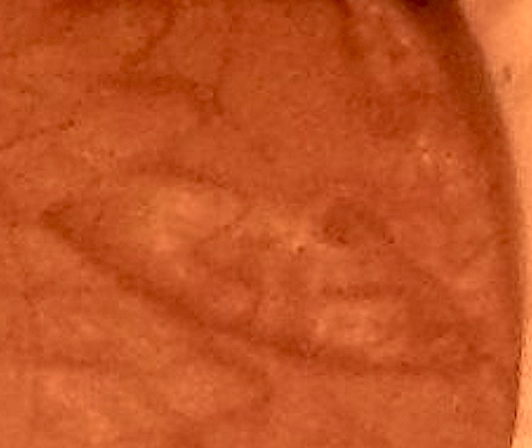 1877-IHC-Error-Coin?-Lamination?pre-Strike?
