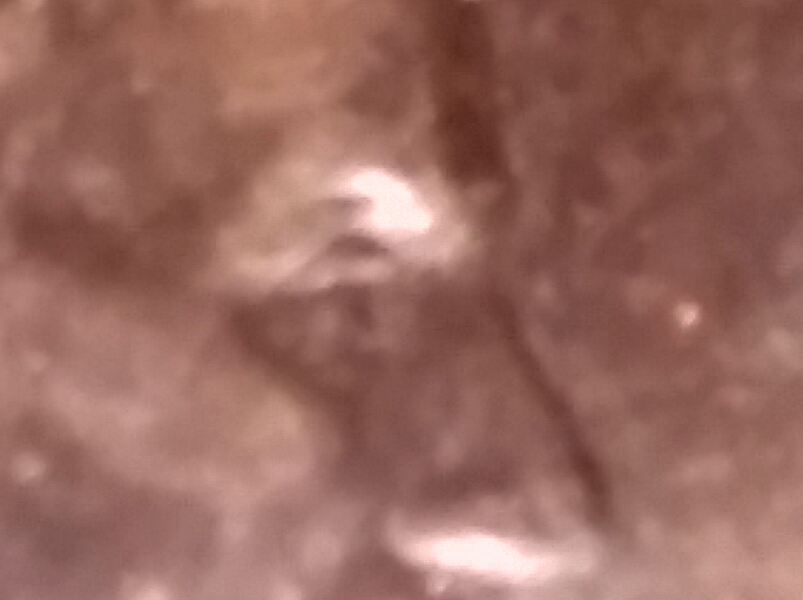 Double-Eyelid?