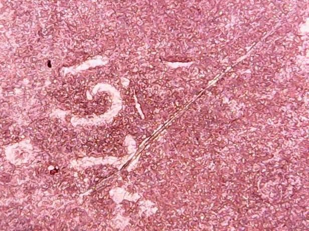 1974-D-LMC-Is-Struck-On-Wrong-Planchet-Or-Damaged-Coin?