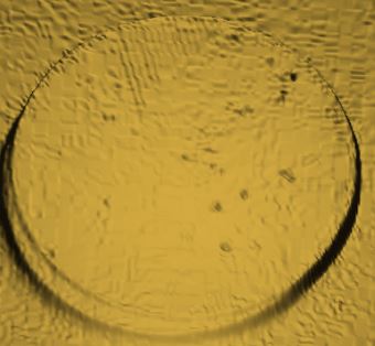 Looking-For-Opinions-On-This-Coin