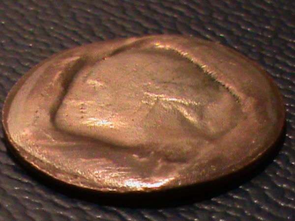 Severe-Quarter-PMD?