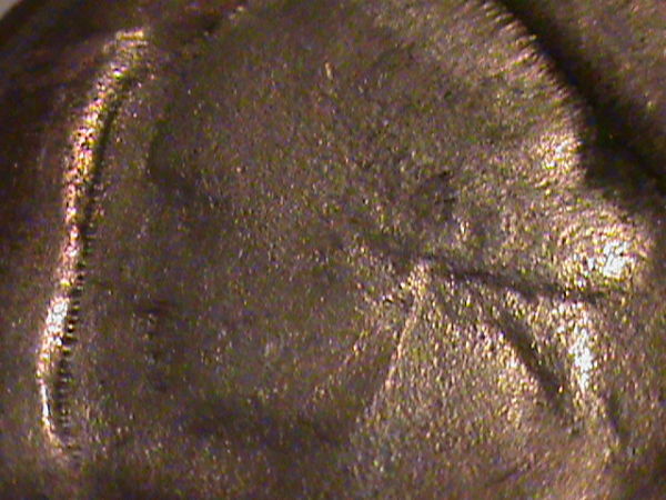 Severe-Quarter-PMD?