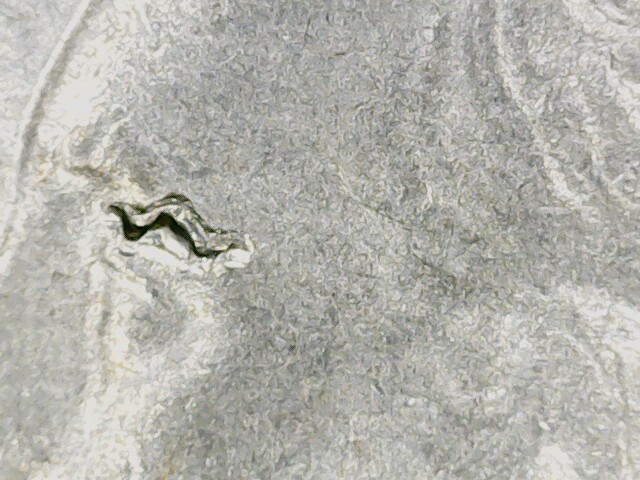 2020-P-Kansas-Quarter-Tallgrass-Prairie-Eyelid-Damage?