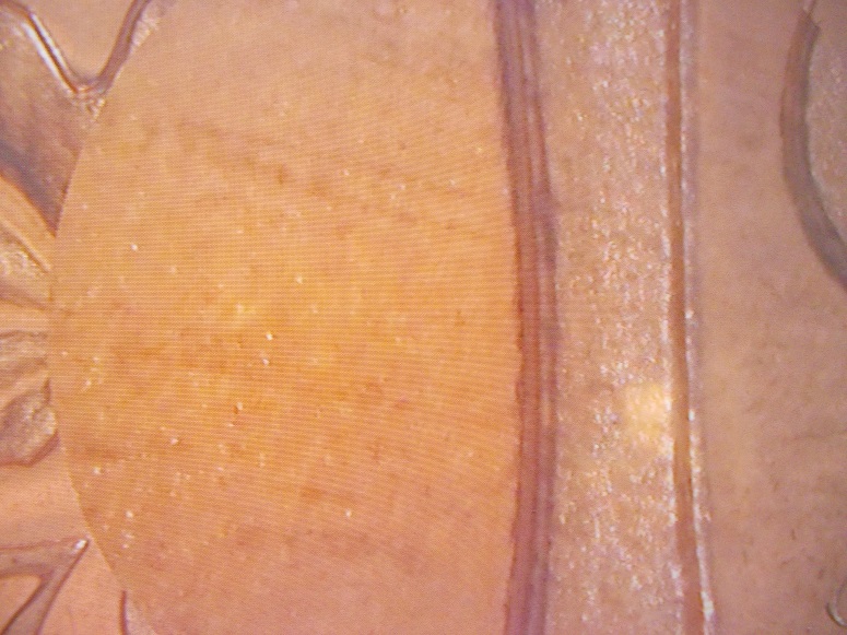 1970-Canada-1-Cent.-Is-This-DDR?