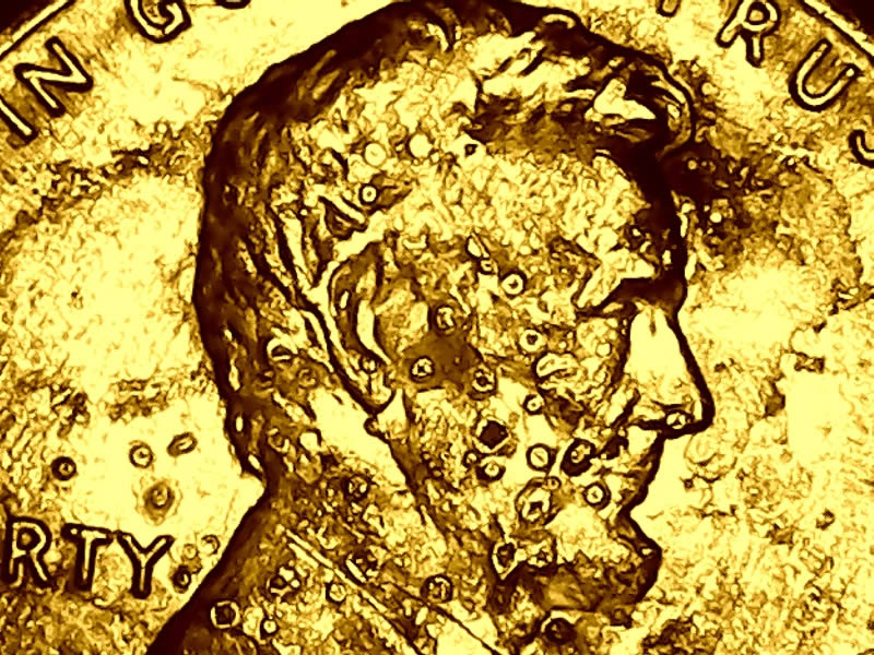 1987-P-Lincoln-With-Chicken-Pox!