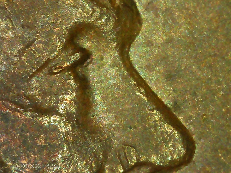 1952-D-LWC-Is-This-Doubling-Under-The-Eyelid?