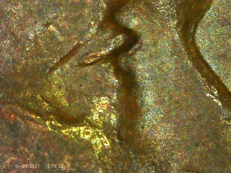 1952-D-LWC-Is-This-Doubling-Under-The-Eyelid?