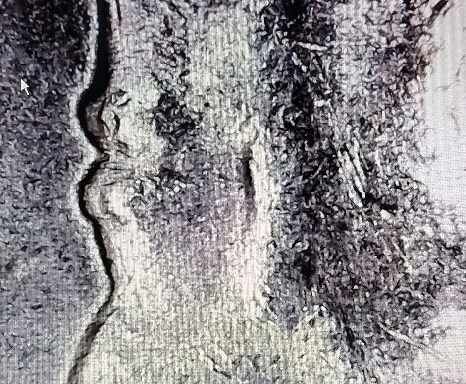 1981-D-Kennedy-Hd-Doubled-Inner-Ear