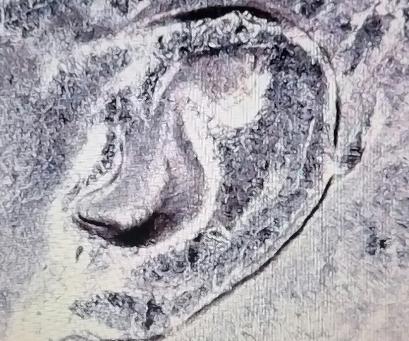 1981-D-Kennedy-Hd-Doubled-Inner-Ear