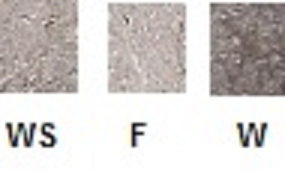 A-New-Type-Portrait-Counterfeit/Forgery
