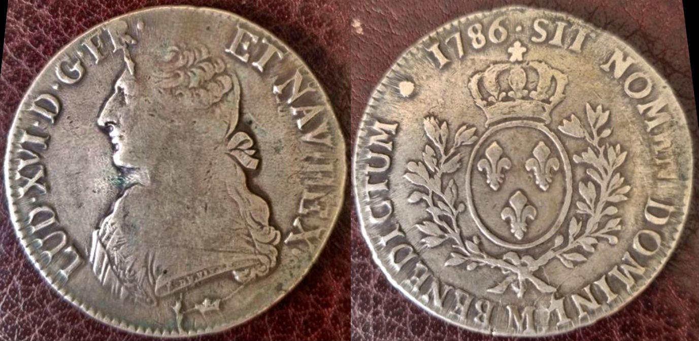 Pre-Frontal-Lobotomy-Of-Poor-King-Louis-XVI-Die-Crack-Variety