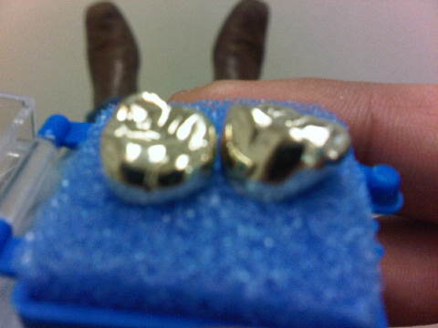 I-Bought-Some-Gold-Today!